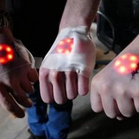 Implanting LED Lights Under Your Skin, The Latest Bio-hacking Trend